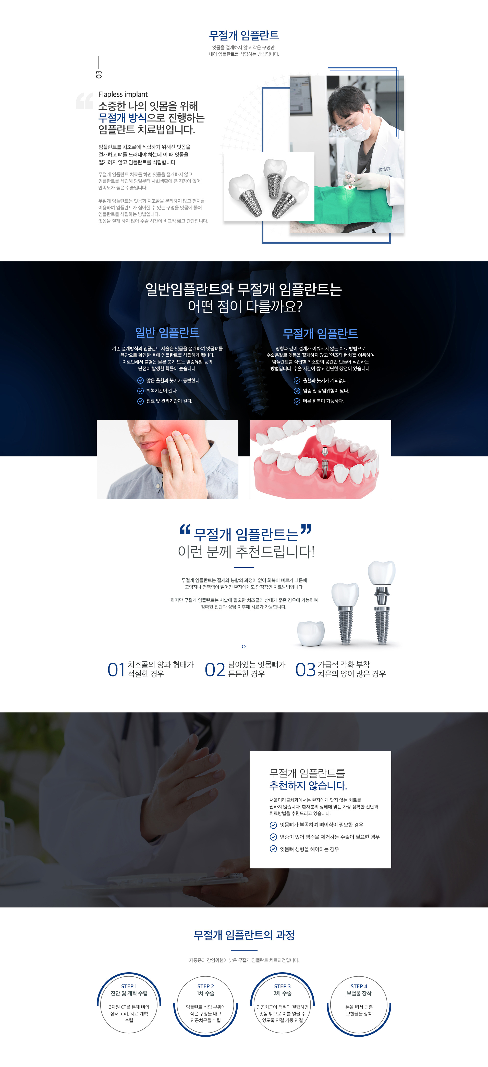 무절개 임플란트