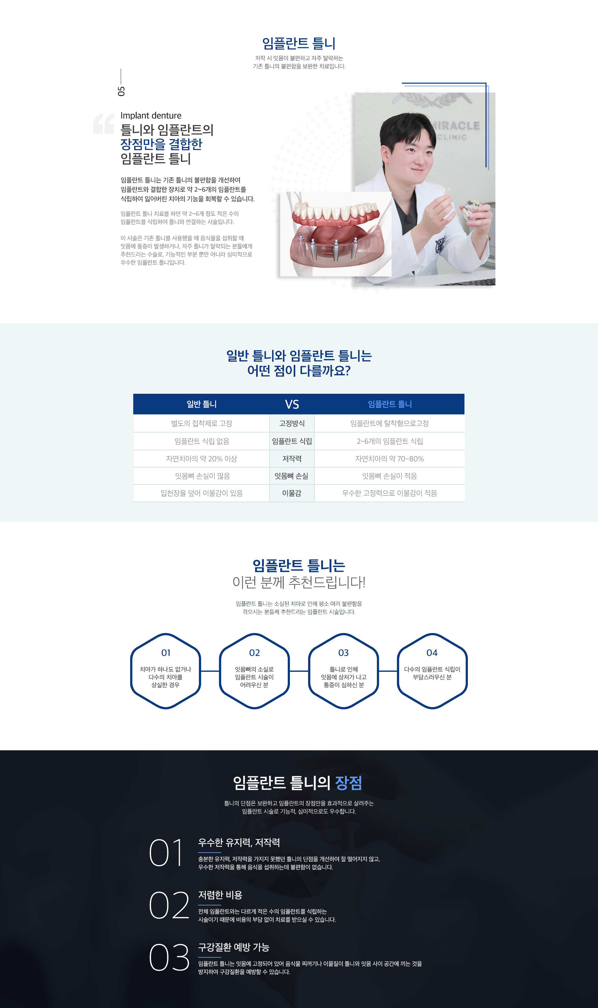 임플란트 틀니